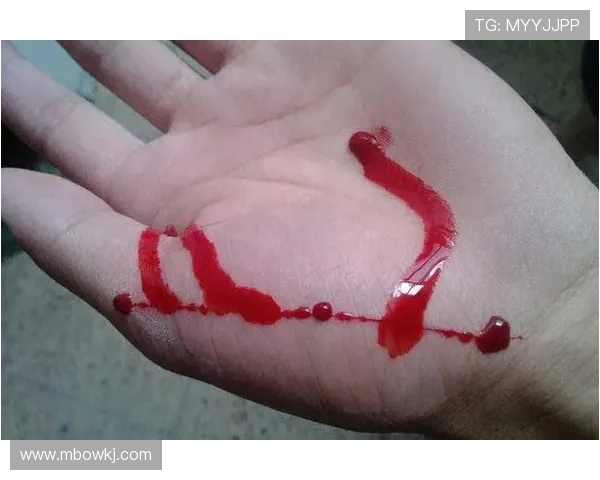 克尔斯托维奇造点建功晒伤口照 克尔斯托维奇造点建功晒伤口照